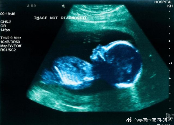 2022年苏州省妇幼保健院供卵试管婴儿成功率、费用及流程指南