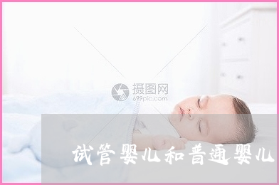 用于借卵试管婴儿的炔雌醇环丙孕酮片--服用炔雌醇环丙孕酮片