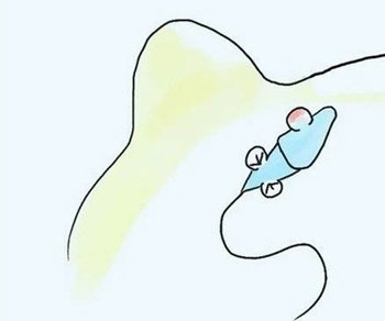 赠卵试管婴儿对男性精子的要求是什么？(1)