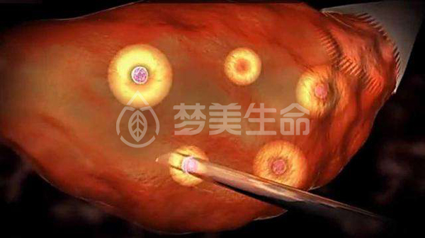 第一时间的健康。做供卵做试管婴儿是否可以不考虑女性的年龄？