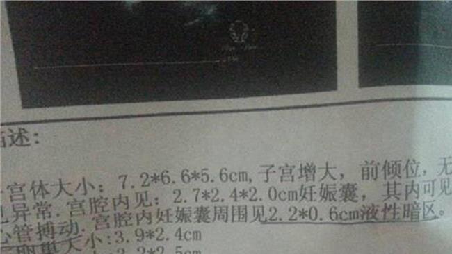 供卵试管婴儿冷冻胚胎移植的成功率是否比新鲜胚胎高？不一定!