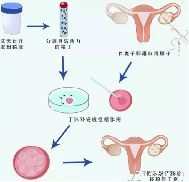 盐城哪家做借卵试管代怀公司医院口碑好？