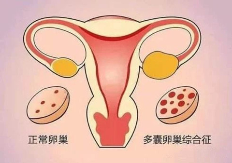 供卵试管怀孕一个月流血,想知道一般多久才能稳定