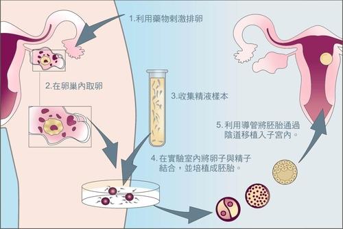 浙江可以开展供卵做借卵试管医院卵子库供卵的医疗机构有哪些