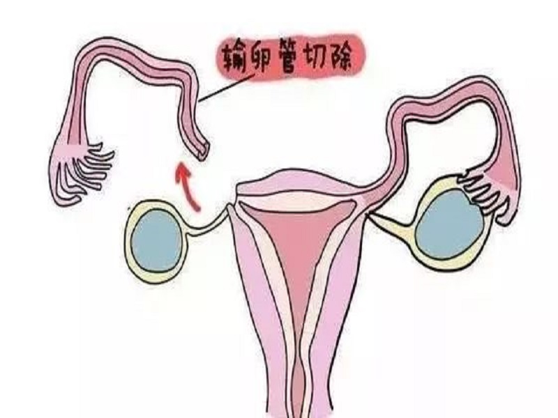 借卵试管婴儿移植第一次鲜胚失败第二次