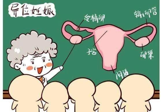男人无精怎么做供卵试管婴儿