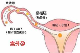 苏州北大医院做供卵试管婴儿能选性别吗