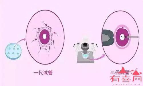 美中宜和妇儿医院借卵试管成功率