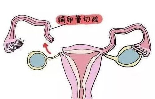 苏州哪家做试管最好