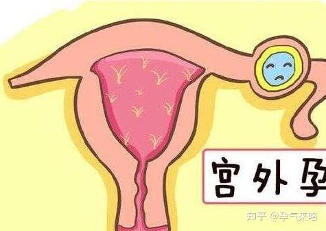 第一次移植失败第二次移植需要多少钱