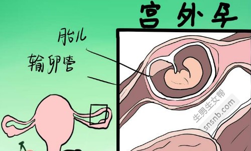 苏州供卵2023代生孩子联系方式医院排名公开,附2023供卵三试管代怀外国人一览