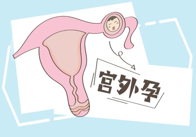 苏州2023借卵代生孩子的医院有哪些(苏州失独再生的医院有哪些好)