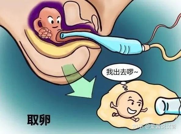 江苏苏州看不孕不育的生殖医院哪家比较好一