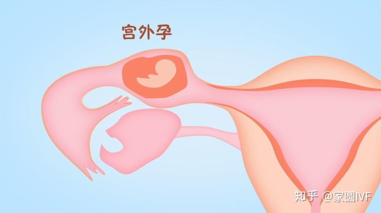 人类精子库费用+使用人类精子库的
