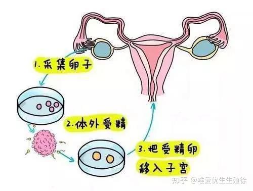 「助孕意思」代怀捐卵中介疼痛程度试管代怀