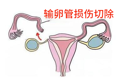 脑供血不足卵磷脂片（脑供血不足吃去疼片可以吗）