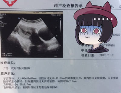 二代试管加卵子激活
