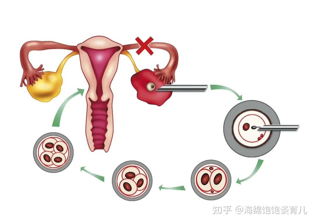 供卵代怀是什么意思公立医院不用等卵子的