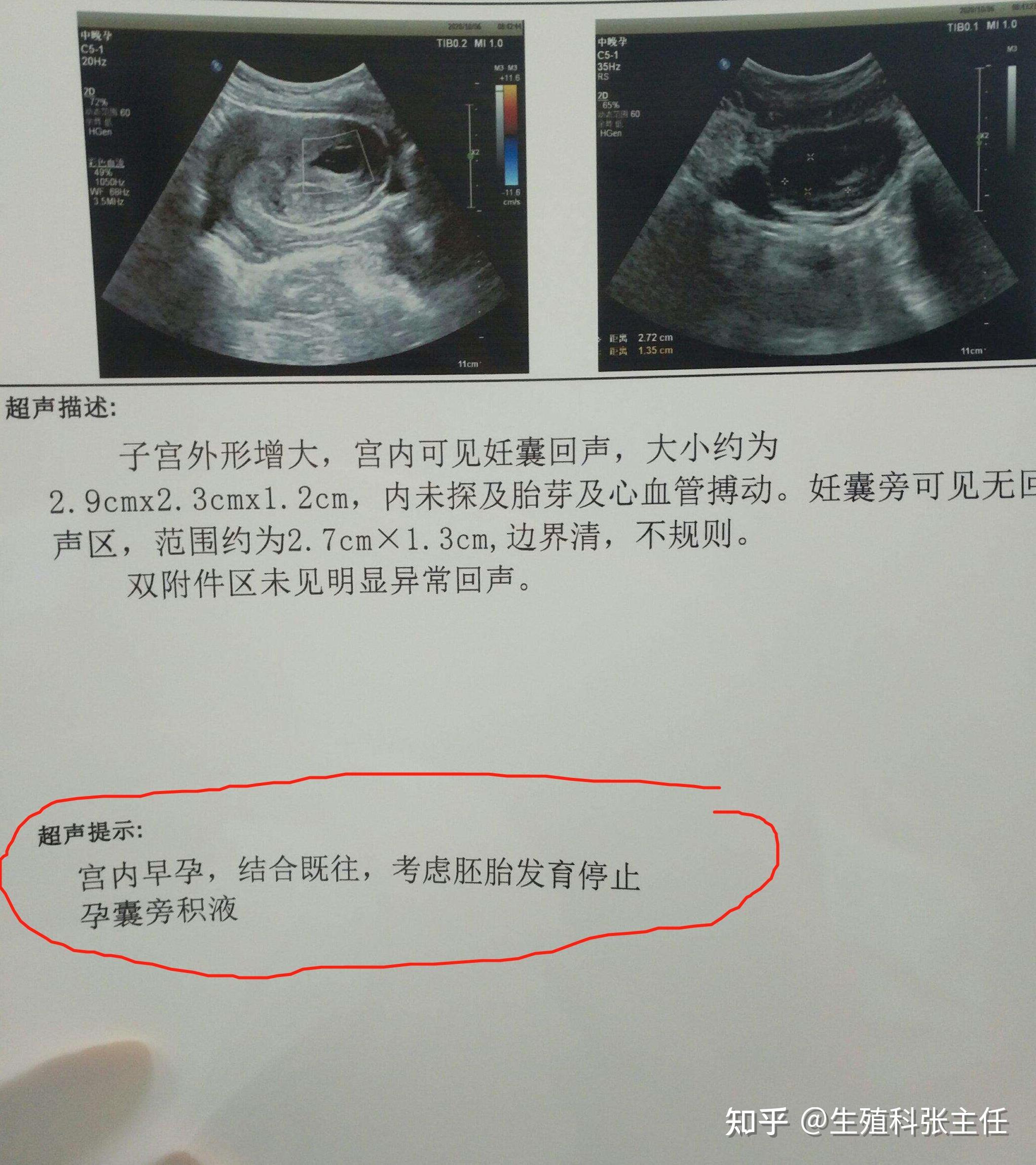 苏州婴儿试管过程