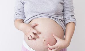 试管代怀费用哪家便宜生孩子有限制吗+
