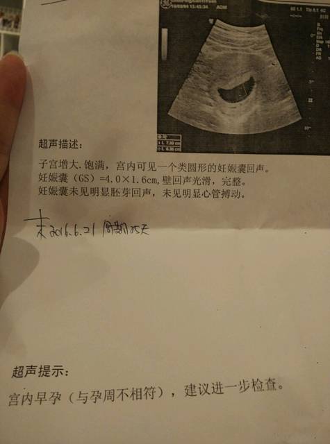 江苏苏州协和医院国外男人试管代怀进周期后的流程图是怎么样的