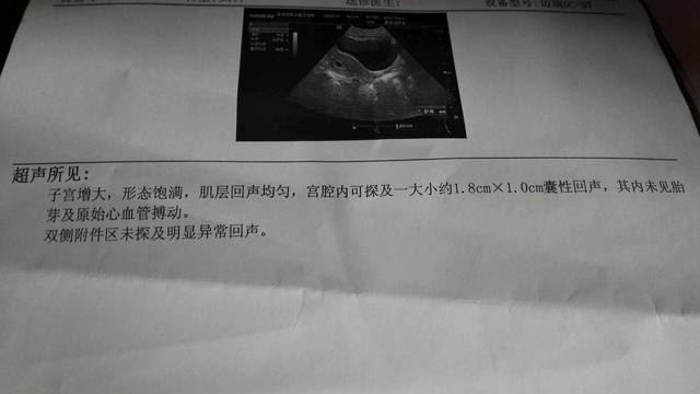 2024江苏苏州借卵试管代怀零风险的中介费标准是多少