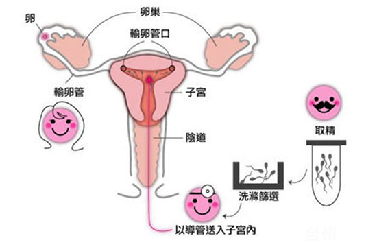 正规医院试管代怀取卵后几天会养囊