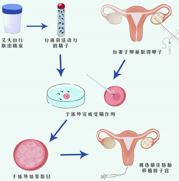 试管移植2个三天的鲜胚成功率会更高吗