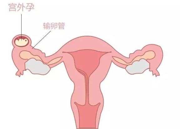 苏州妇幼保健院给费用试管代怀多少钱（江苏