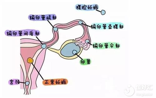做借精试管婴儿费用过程是怎么样的（上南方挂号可以直接就诊）