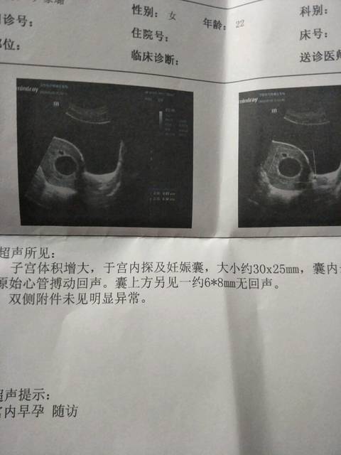 苏州国内代生男孩价格婴儿有哪些医院好