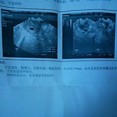 江苏苏州合法助孕机构包生男（哪里有代怀双