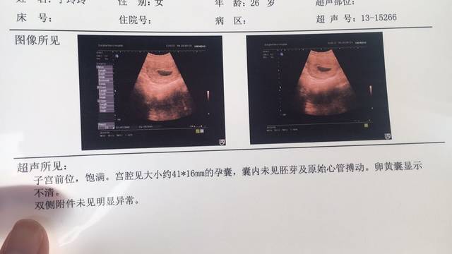 精子少吃什么能补精子